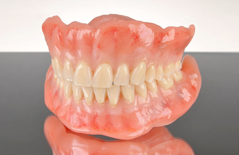 超精密義歯